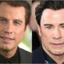 Seberte odvahu a prohlédněte si to nejhorší z plastické chirurgie slavných mužů - John Travolta