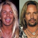 Seberte odvahu a prohlédněte si to nejhorší z plastické chirurgie slavných mužů - Vince Neil