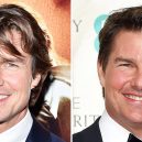 Seberte odvahu a prohlédněte si to nejhorší z plastické chirurgie slavných mužů - Tom Cruise