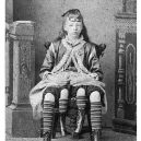 Myrtle Corbin: Dívka z Texasu, která měla čtyři nohy - 2vcg5e1