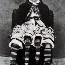 Myrtle Corbin: Dívka z Texasu, která měla čtyři nohy - myrtle-corbin-2fe56086-be56-487c-be71-5b412c894e5-resize-750