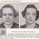 18 pacientů, kteří podstoupili lobotomii. Fotografie před a po tomto lékařském zákroku - lobotomy-before-and-after-13