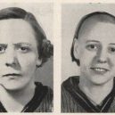 18 pacientů, kteří podstoupili lobotomii. Fotografie před a po tomto lékařském zákroku - lobotomy-before-and-after-9