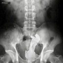 15 opravdu bizarních rentgenových snímků - weird-x-rays-buzz-lightyear