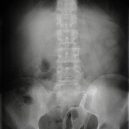 15 opravdu bizarních rentgenových snímků - weird-x-rays-headless-barbie