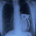 15 opravdu bizarních rentgenových snímků - weird-x-rays-live-grenade