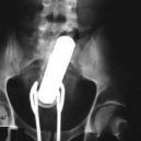 15 opravdu bizarních rentgenových snímků - weird-x-rays-tongs