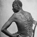 Fotografie, která surovostí vypověděla o otroctví víc než mnohá svědectví - whipped-slave-gordon (1)