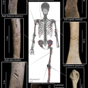 „Tsukumo No. 24“ – první známá oběť žraločího útoku - wounds-of-oldest-shark-attack-victim